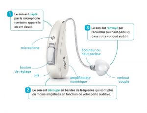 fonctionnement appareil auditif