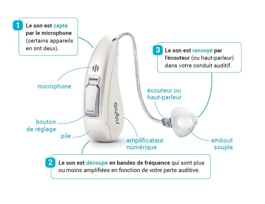 Comment mettre un appareil auditif dans l'oreille ?