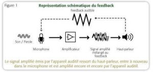 fonctionnement appareil auditif