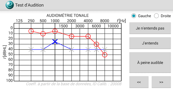 audiometrie