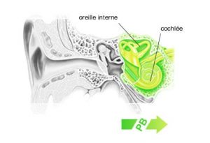 perte auditive perception
