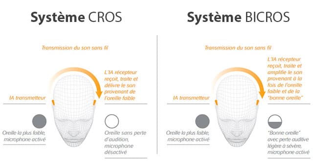 systeme cros