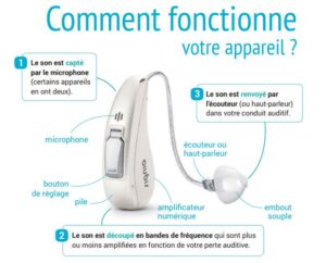 Comment fonctionne un appareil auditif