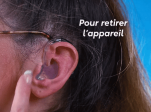 Retirer un appareil auditif BTE