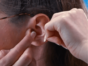 mettre un appareil auditif intra auriculaire
