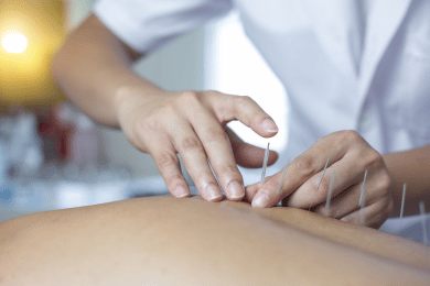 Acupuncture et acouphènes : une solution naturelle