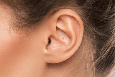 Bouton dans l’oreille : quand s’inquiéter et que faire